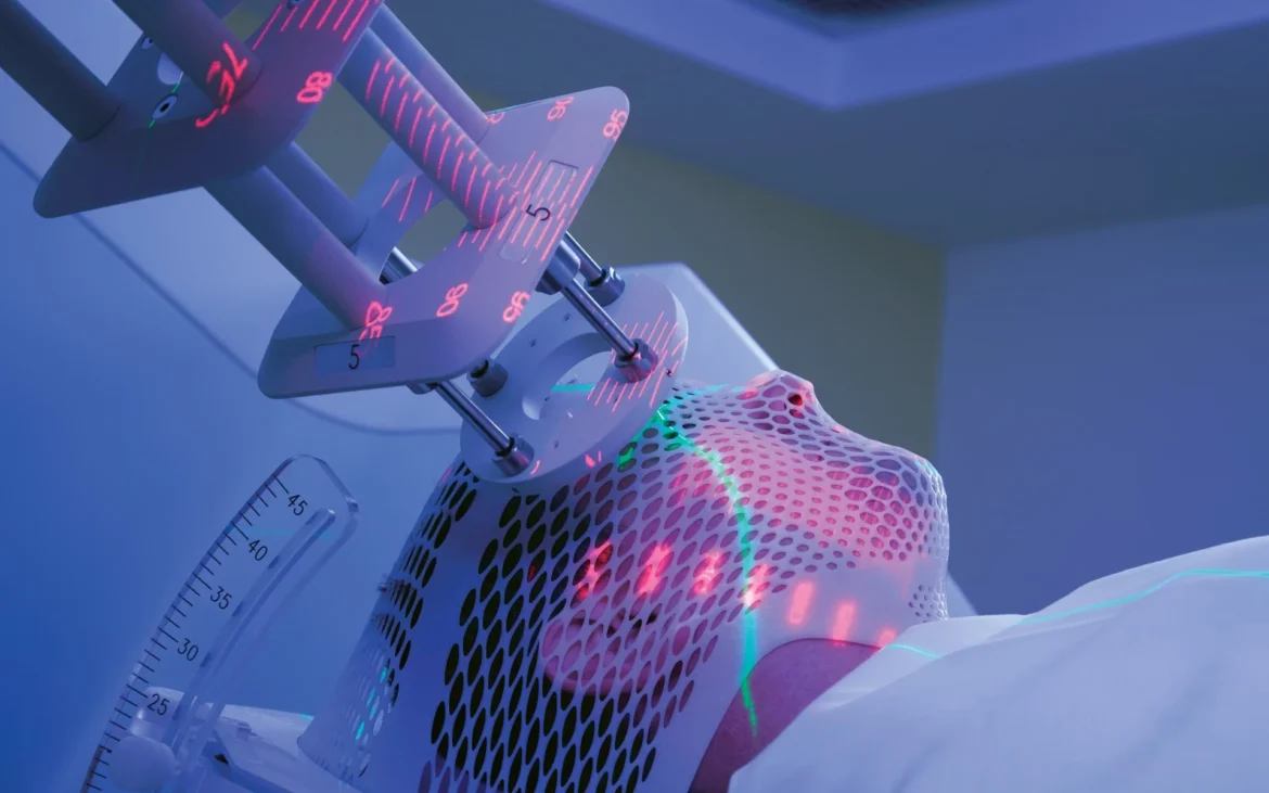 LA RADIOTHÉRAPIE FLASH